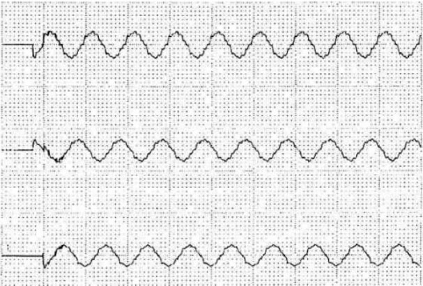 l_P(gun)rΈD